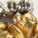 Gold Ankauf Hamburg die Scheideanstalt kauft Ihr Zahngold-gelb-und-weiss